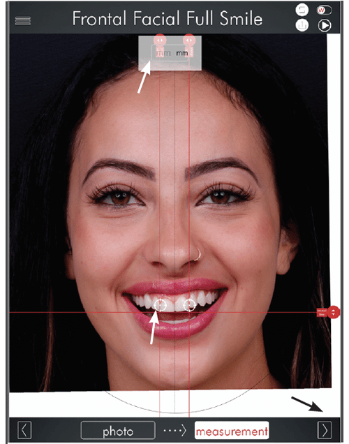 Digital Smile Design Photo 2