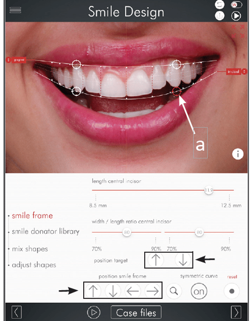 Digital Smile Design Photo 2a