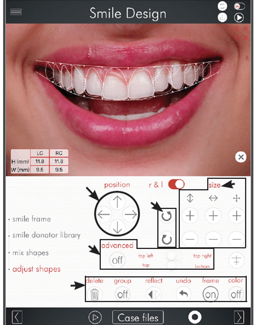 Digital Smile Design Photo 3