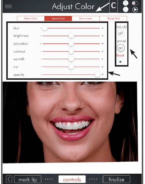 Digital Smile Design Photo 4