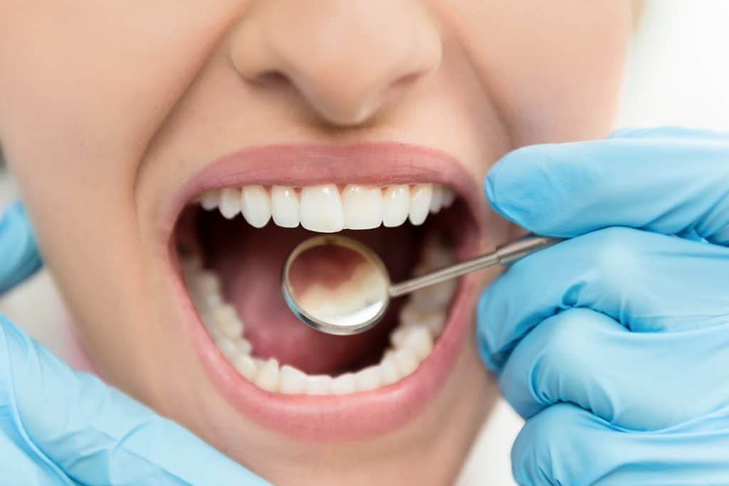 How Long Does a Deep Teeth Cleaning Take?