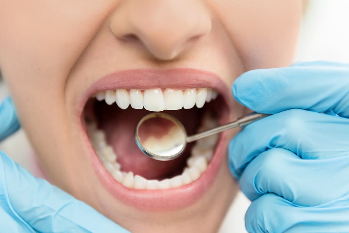 how-long-does-a-deep-teeth-cleaning-take