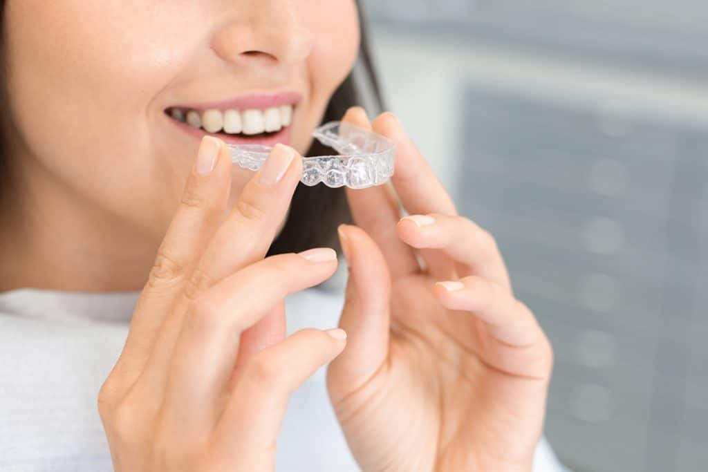 How Much is Teeth Whitening in Cambridge, MA?