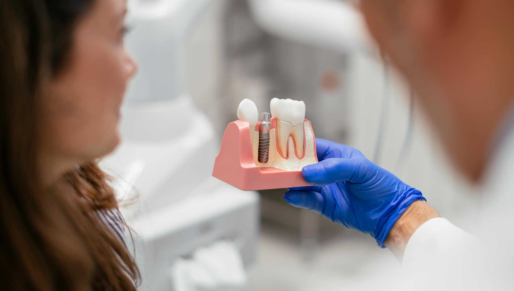 Dental Implant Model Photo