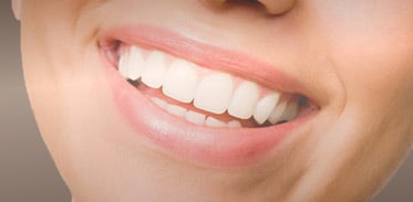 Smiling woman with beautiful teeth